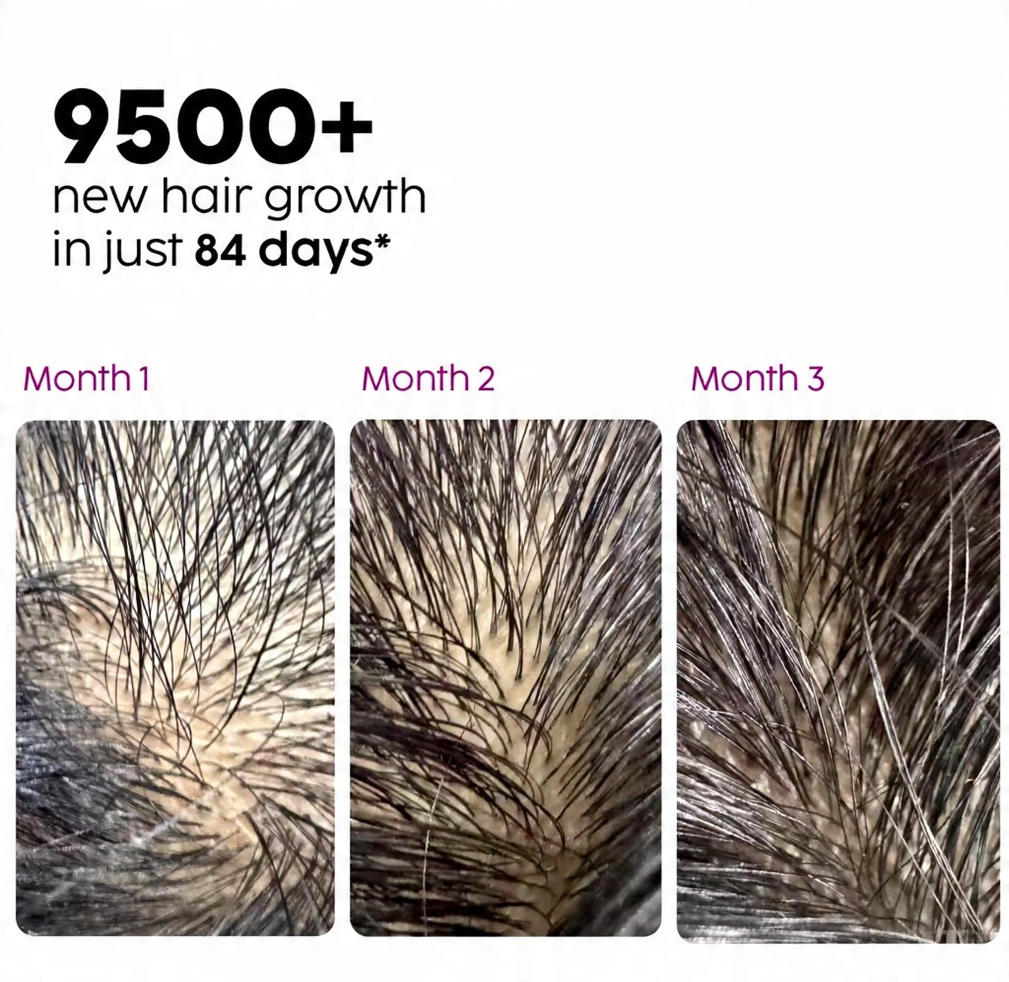 Extreme Hair Growth Oil 100 ML